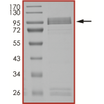 EGFR (d746-750 T790M L792F), Active